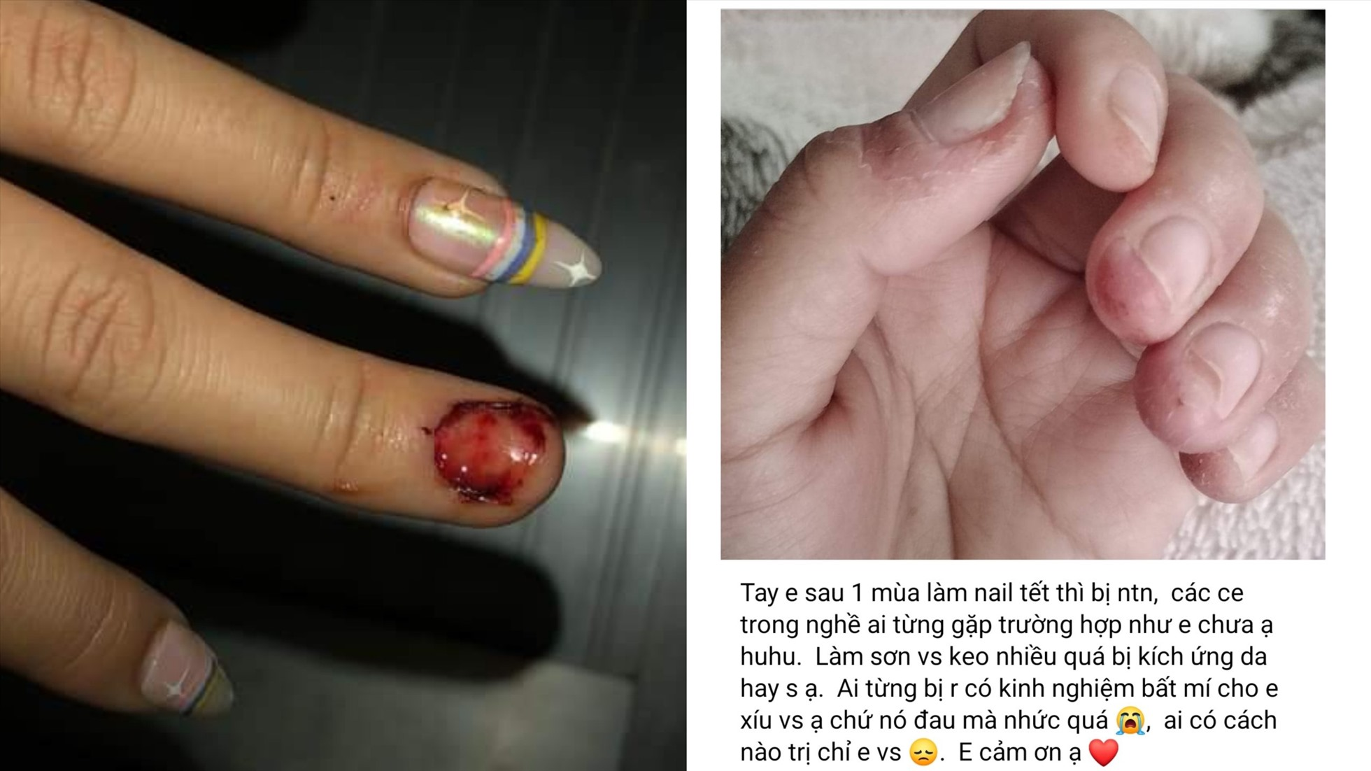 Mẫu nail 27