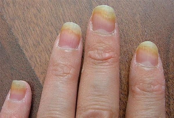 Mẫu nail 58